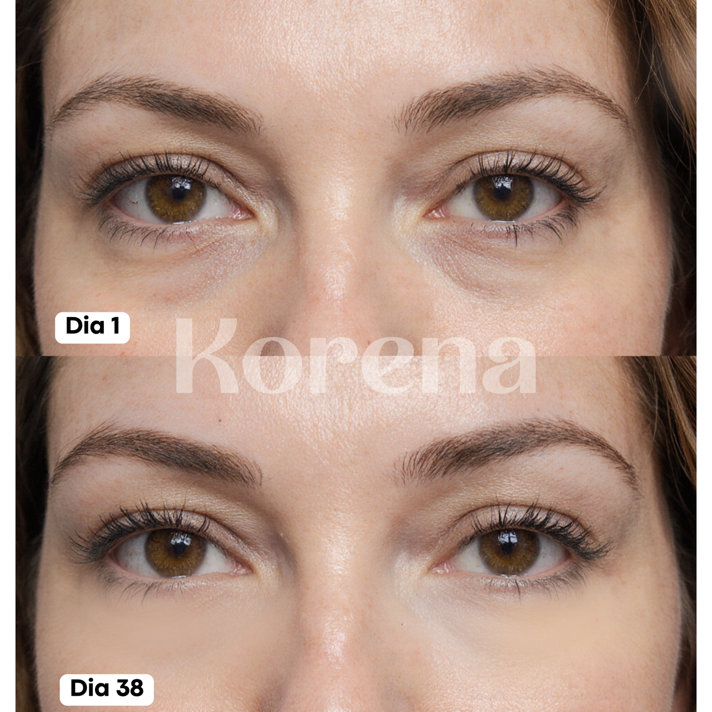 Contorno Con Rodillo Drenador Korena